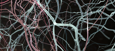 Nursing Masterclass - Windows Into the Brain: Bedside Neuromonitoring ICP and Beyond